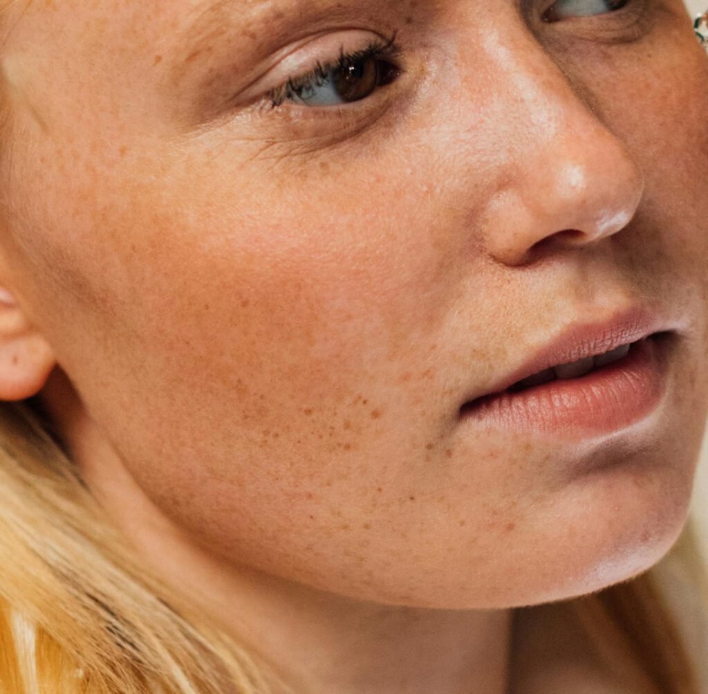 how to detox acne